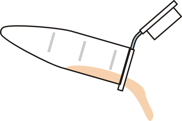 Eppendorf Supernatant (600x400)