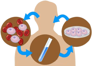 Ultrasound Guided Stem Cell Therapy - Stem Cell Treatment (450x293)