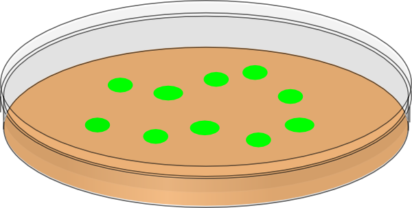 Orange Petri Dish With Greeen Bacterial Colonies Clip - Bacterial Pink In A Petri Dish (600x303)