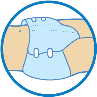 To Ensure That The Diaper Fits Correctly, Fixate The - To Ensure That The Diaper Fits Correctly, Fixate The (351x351)