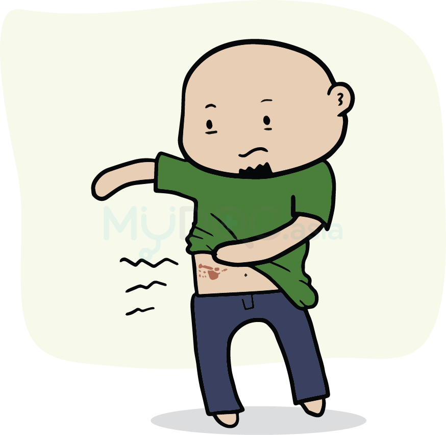 Juliet Station Shingles Check - Shingles (874x851)