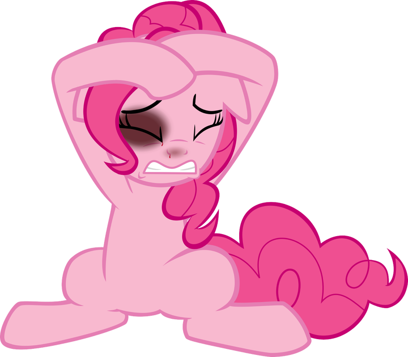 Pink Eyes Clipart Bruised - Hypertension (800x700)