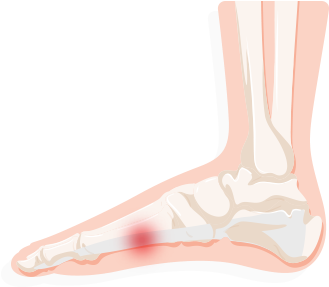 Feet Clipart Foot Heel - Sock (383x341)