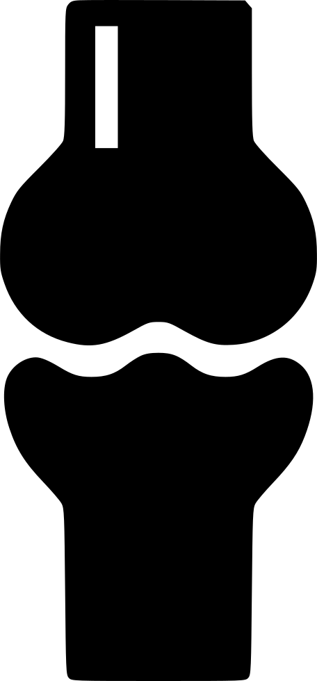Knee Joint Joint Bone Skeleton X Ray Comments - Knee Joint Joint Bone Skeleton X Ray Comments (456x980)