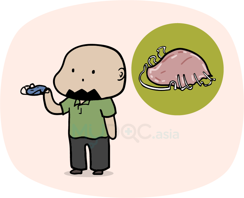 Hawley Retainers Are Simple-looking Metal Wire Retainers - Retainer (800x650)