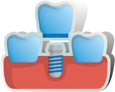 Dental Implants - Chair (500x500)