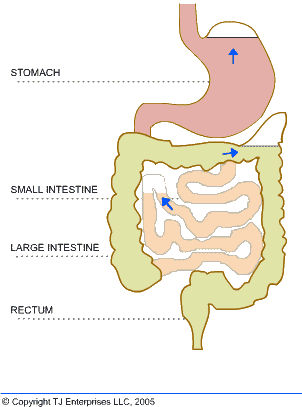 Trapped Gas Causes Blockages And Bloating In The Intestines - Flatulence (302x407)