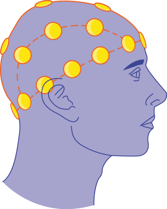 Download The Image Download The Entire Set - Download The Image Download The Entire Set (545x680)