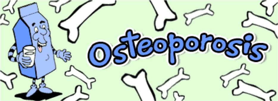 Loss Of Bone Mass Throughout The Skelton, Predisposing - Osteoporosis Animasi (946x437)