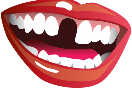 Download Wallpaper Full Wallpapers The World Widest - Smile With Missing Tooth (450x300)