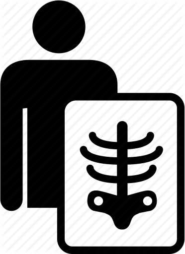 Chest X Ray Png (372x512)