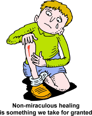 Skinned Knee - Video (319x400)