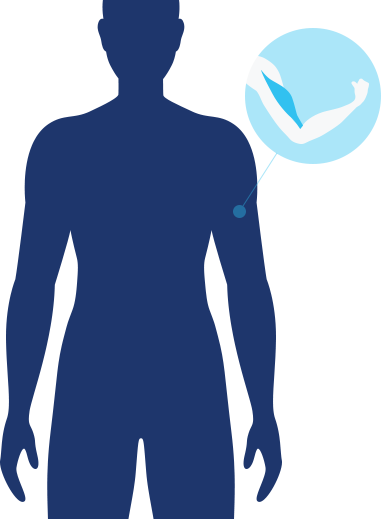 Clip Art Royalty Free Library Loss And Recovery As - Muscle Loss Icon (381x519)