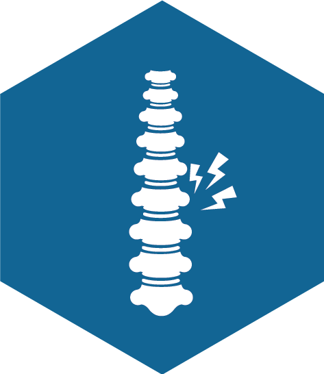 Cervical Myelopathy - Cervical Myelopathy (473x546)