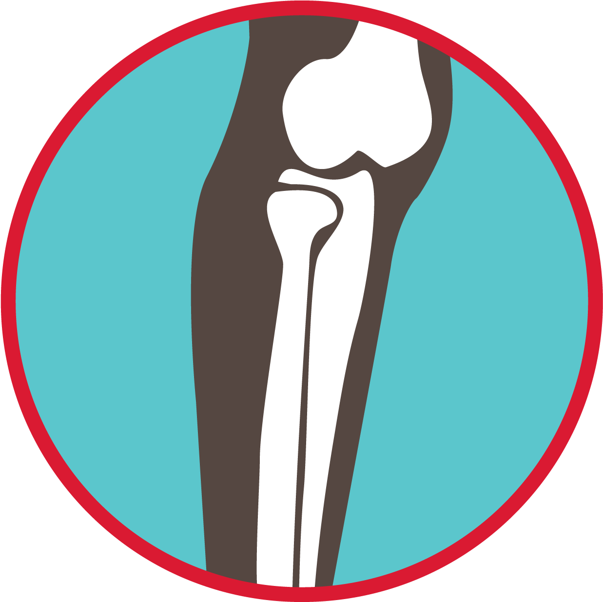 Bones Of The Leg Graphic - Howth (1251x1251)