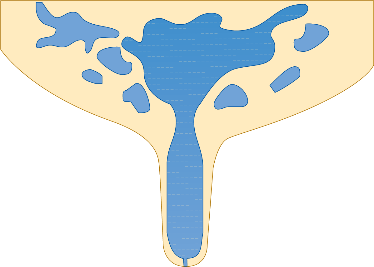 Air And Gases In Milk - Deaerator (1200x867)