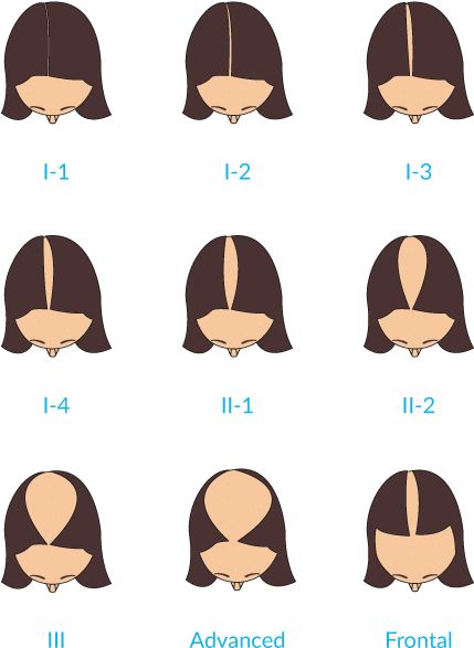 Instead, The Hair Follicles Become Sensitive To Normal - Instead, The Hair Follicles Become Sensitive To Normal (470x683)