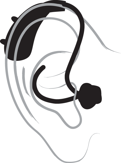 Behind The Ear - Ear With Hearing Aid Drawing (471x635)