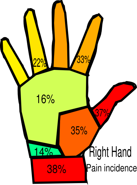 Right Hand Pain Incidence Surgeon Clip Art - Clip Art (438x593)