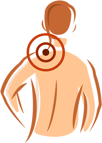 Neck & Shoulder Pain - Neck Pain Clipart Png (350x500)
