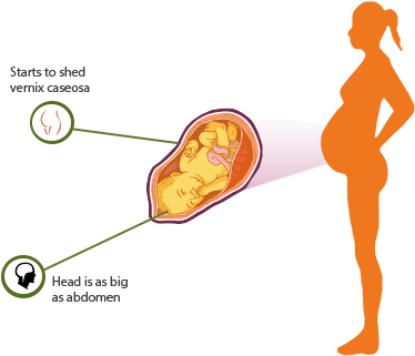 Kims Week - H&m (411x367)