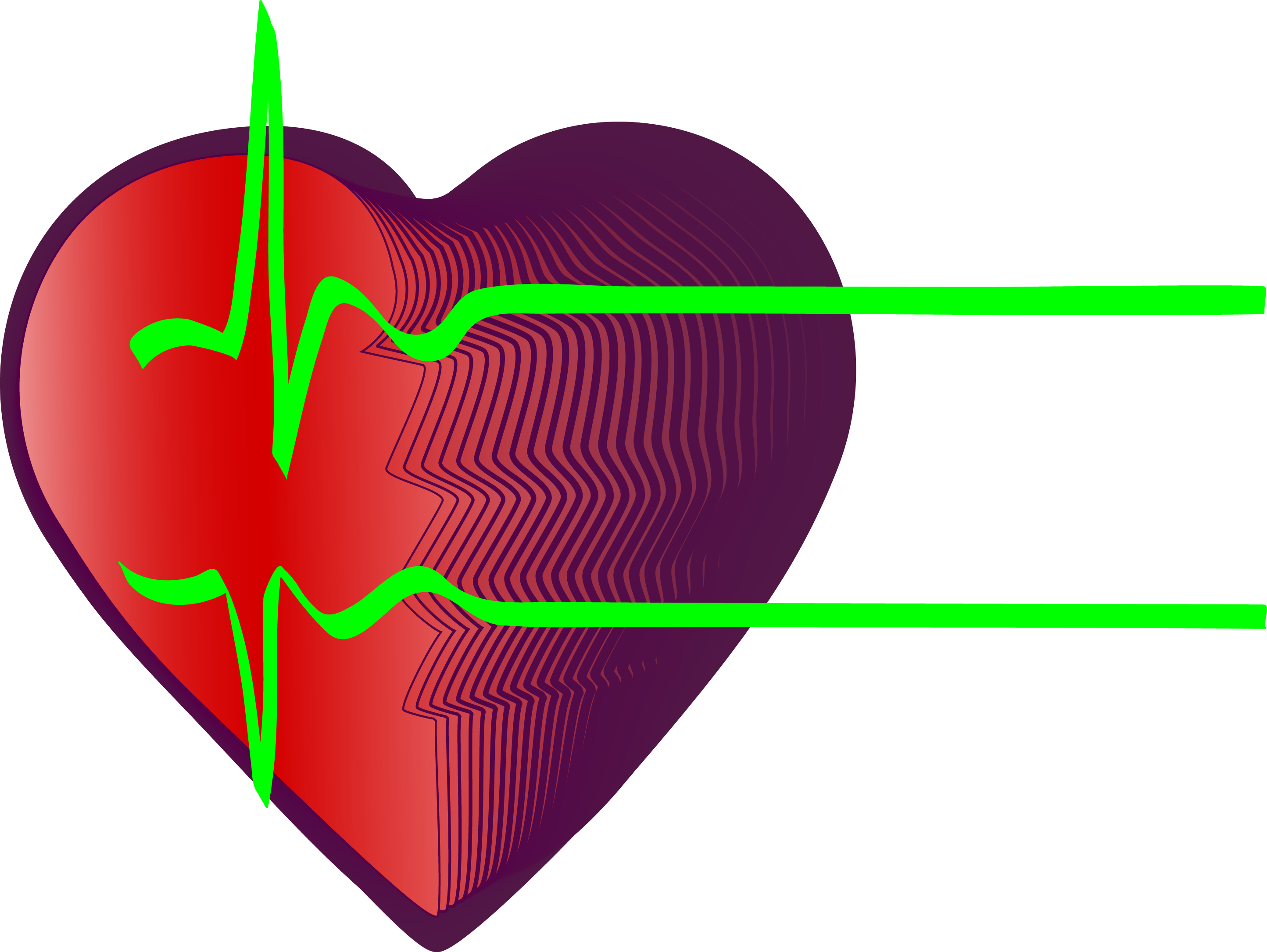 Electrocardiography Heart Rate Myocardial Infarction - Heartbeat (2888x2169)