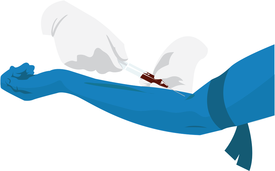 Patient Blood Samples Were Taken With 24 Hours Of Stroke - Patient Blood Samples Were Taken With 24 Hours Of Stroke (1000x641)