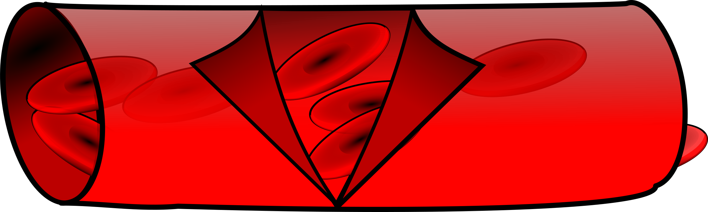 In Case Of Diabetes, Blood Vessels In The Retina Get - Vasos Sanguineos Png (2400x719)