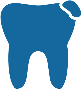 Tooth Colored Fillings - Tooth Colored Fillings (400x339)