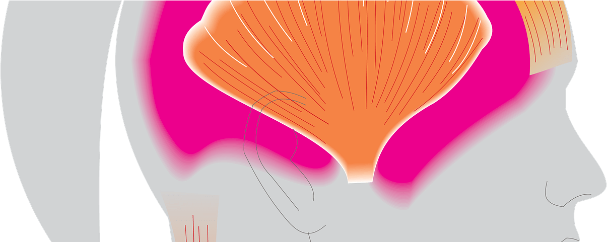 How Whiplash Causes Post Concussion Help - Headache (1280x480)