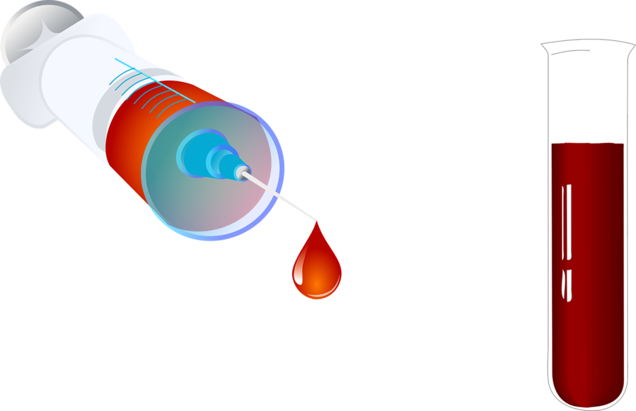 Clipart Resolution 1280*827 - Blood Test Tube Png (899x581)