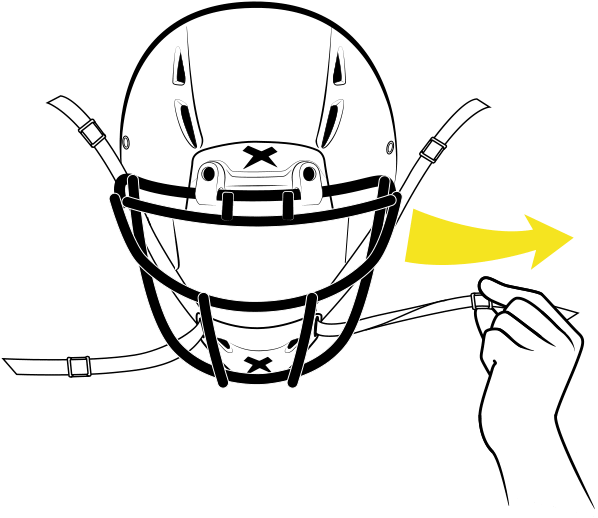 1remove The Existing Chin Cup - Xenith (696x695)