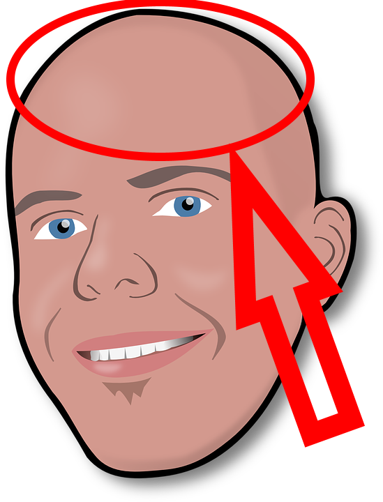 Clip Black And White Download Big A Cabea Careca - Head Clip Art (549x720)