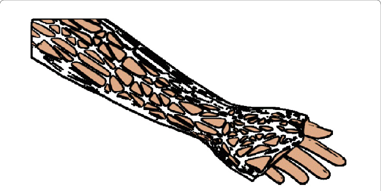 3d Printed Exoskeleton, Substitute For Conventional - 3d Printing (761x382)