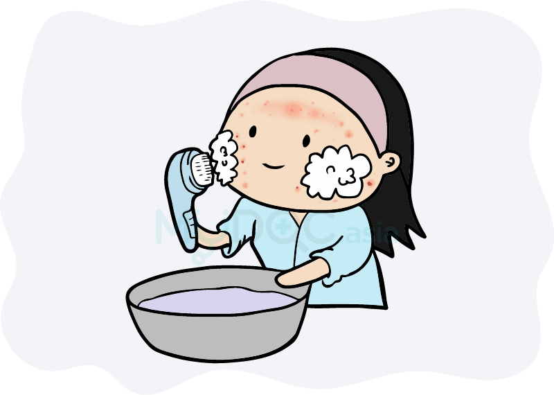 Acne Skin Use Facial Cleansing Brush - Skin (800x570)