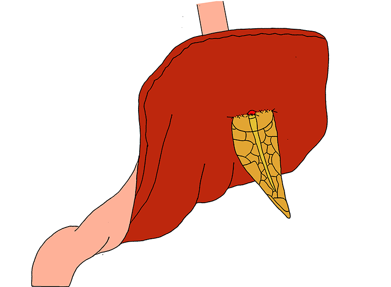 Pancreatic Duct And The Full-thickness Of The Gastric - Mucous Membrane (800x800)