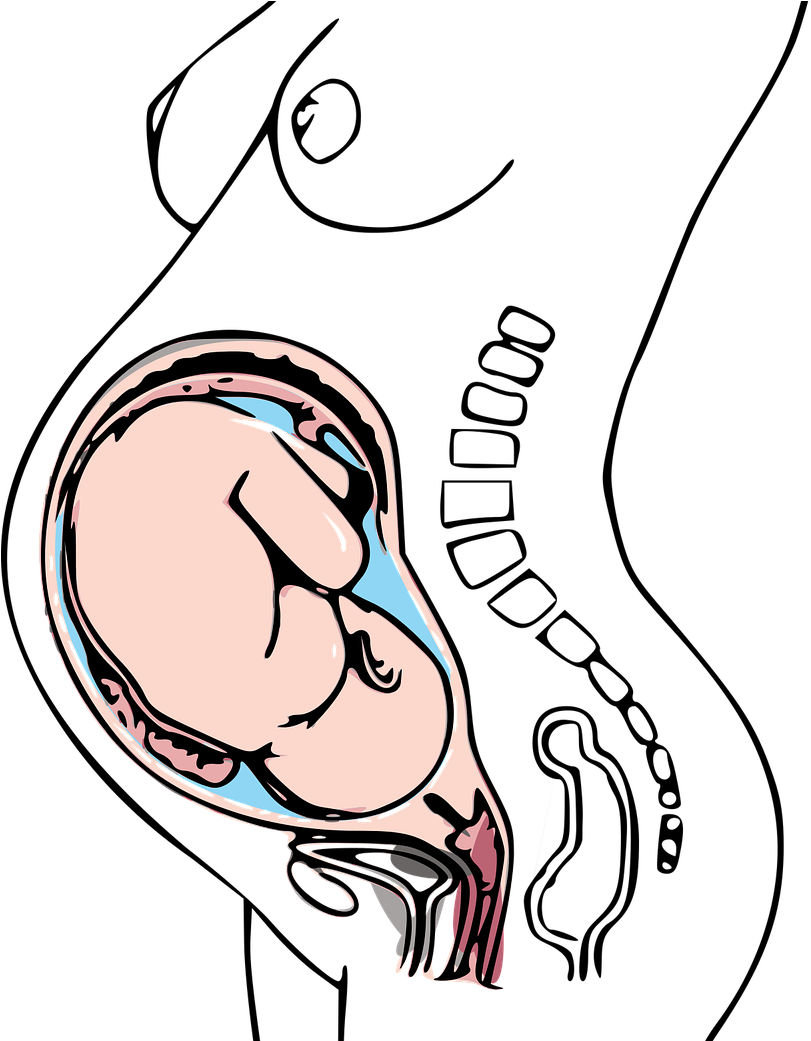Low Dose Aspirin Can Help With Pregnancy Gerti Tashko, - Low Dose Aspirin Can Help With Pregnancy Gerti Tashko, (828x1040)