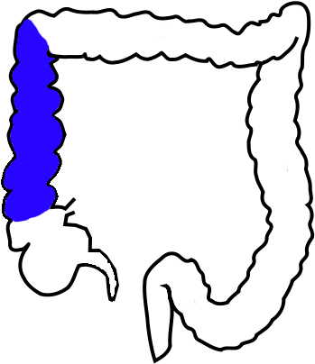 Cecum Of A Dog (376x418)