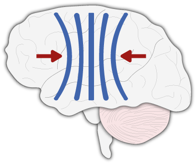 How Are Surgeons Affected When Things Go Wrong, And - Illustration (600x380)