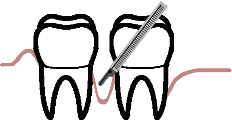 Periodontal Disease Is The Second Largest Cause Of - Periodontology (960x480)