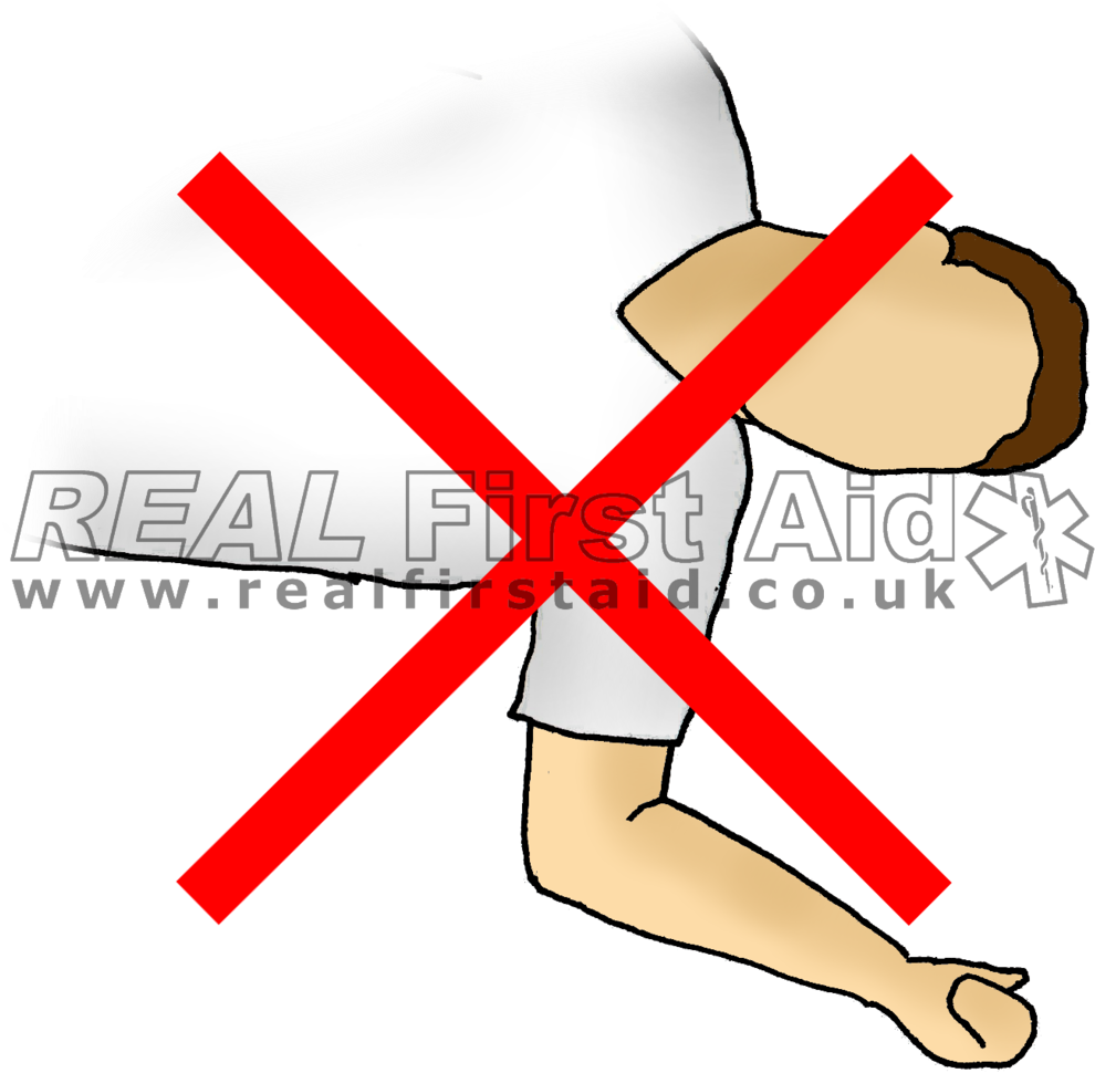 Casualty Positioning Real First Aid Sap Arms - Dada (1000x982)