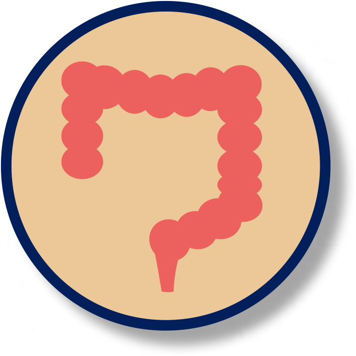 Bowel Incontinence - Irritable Bowel Syndrome (743x716)