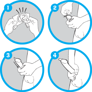 Only When There's No Further Contact With Your Partner's - Take On A Condom (379x377)