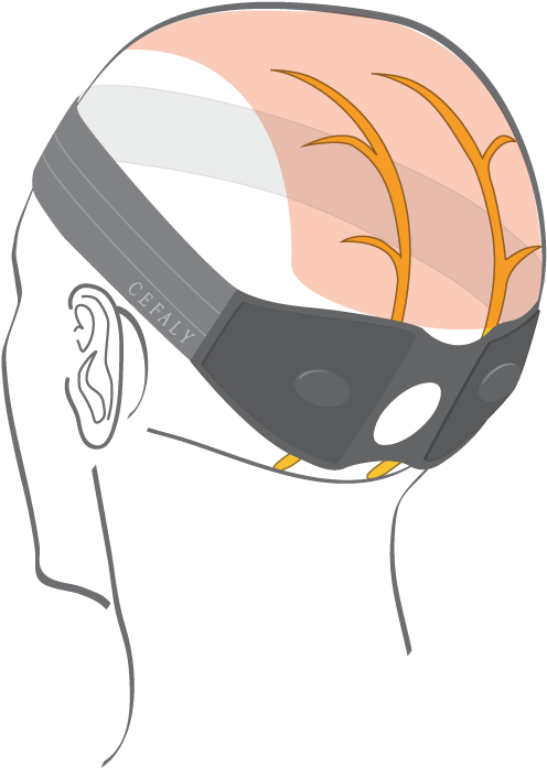 Cefaly Kit Arnold - Cefaly Arnold Kit (600x714)