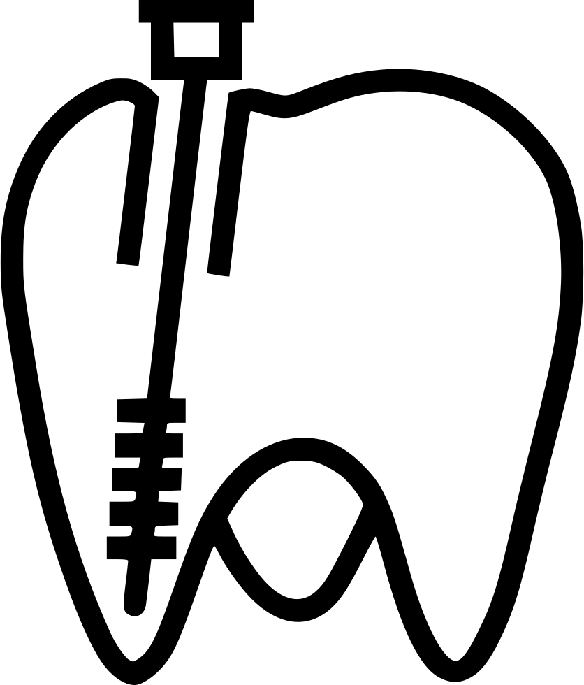 Nerve Channel Treatment Comments - Endodontia Icon (836x980)