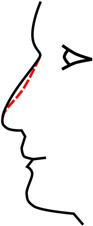 Hence, It Is Commonly Reported That Women See Cosmetic - Nose Clip Art (360x720)