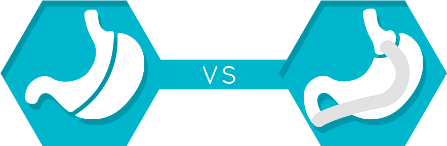 Gastric Sleeve Vs Gastric Bypass Overview - Gastric Bypass Surgery (1100x313)