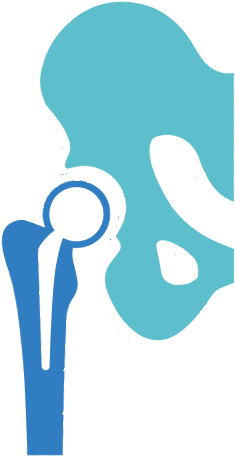 Orthopedic Surgery - Hip Implant Icon (493x496)