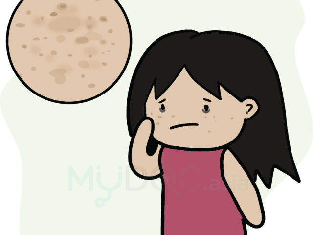 Eye Patch Clipart Translucent - Pigment (640x480)