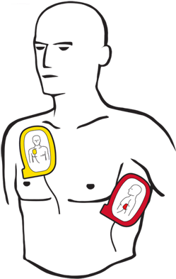 Aed Use Step - Pad Aed (400x400)
